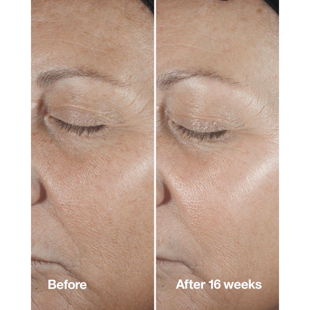 Clinique Smart Clinical Repair Wrinkle Correcting Serum With Retinoid, 30ml