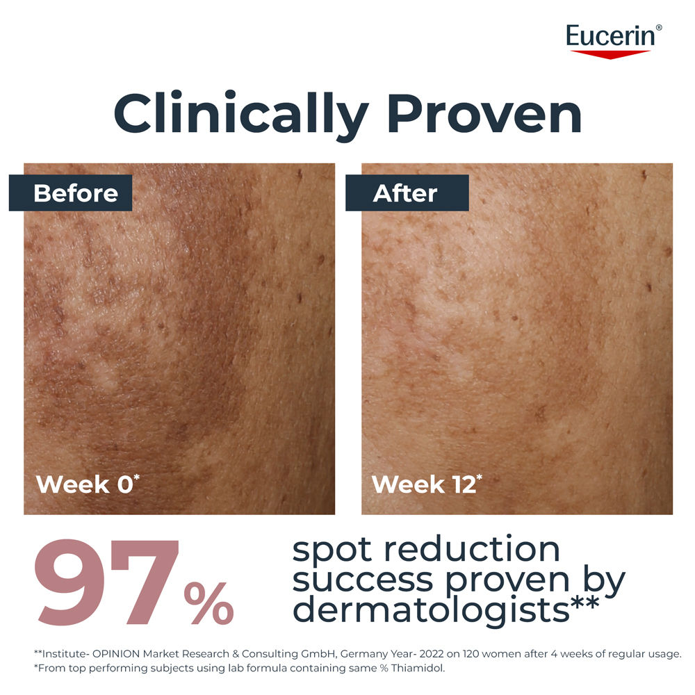 Eucerin Anti-Pigment Day Cream With Sunscreen SPF30 & Thiamidol Reduces And Prevents Dark Spots, 50ml