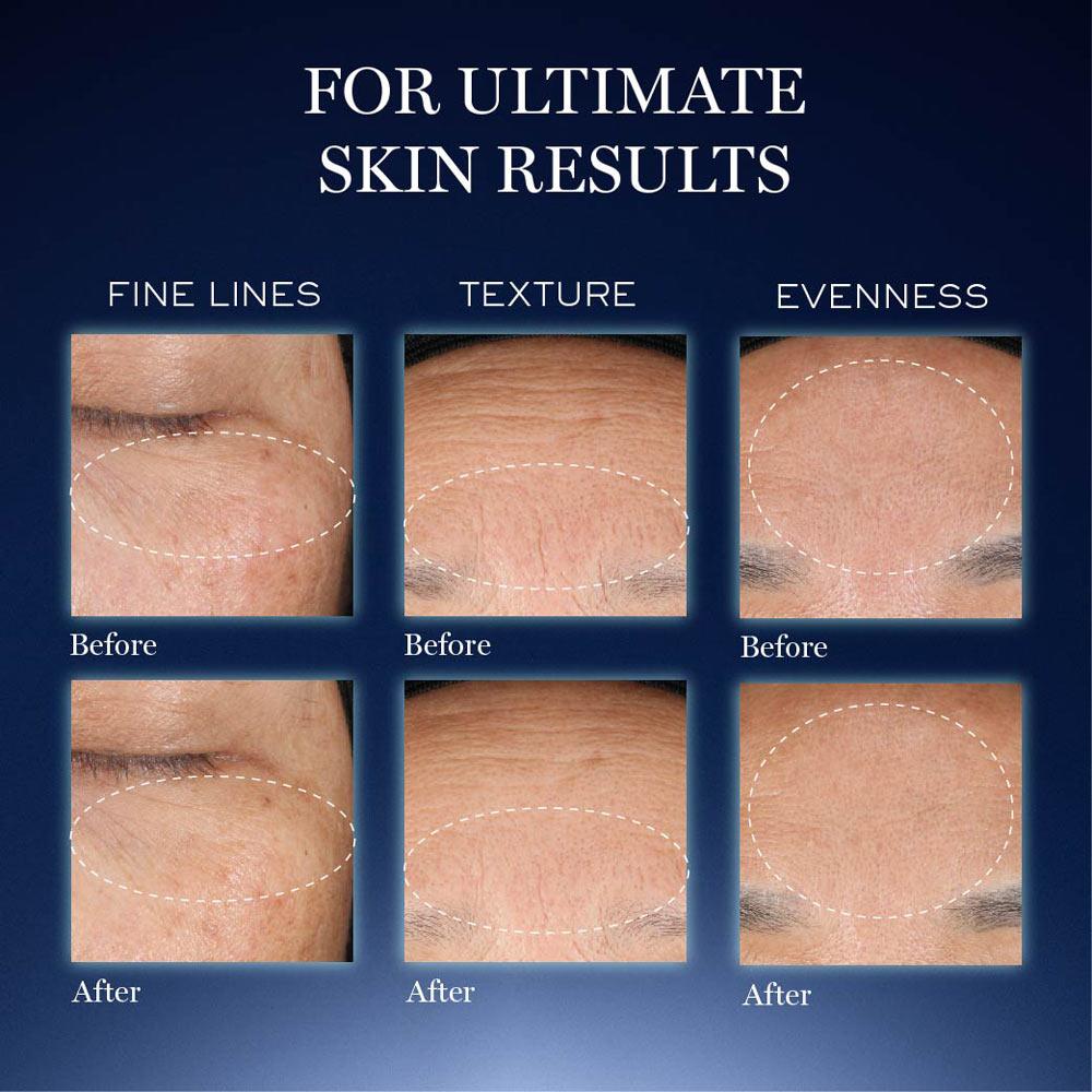 Lancome Genifique Ultimate Skin Repair Serum With Beta Glucan Suited for Indian Skin, 20ml