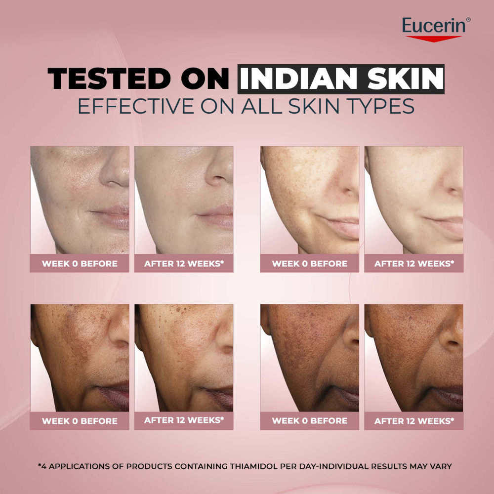 Eucerin Anti-Pigment Dual Serum with Hyaluronic Acid for Age Spots & Skin Tone Correction, 7ml
