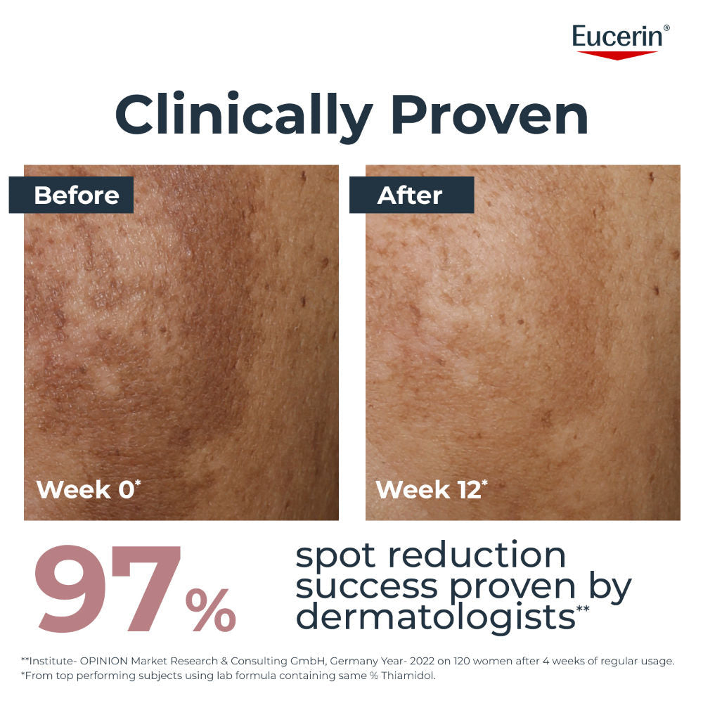Eucerin Anti-Pigment Dual Serum with Hyaluronic Acid for Age Spots & Skin Tone Correction, 7ml