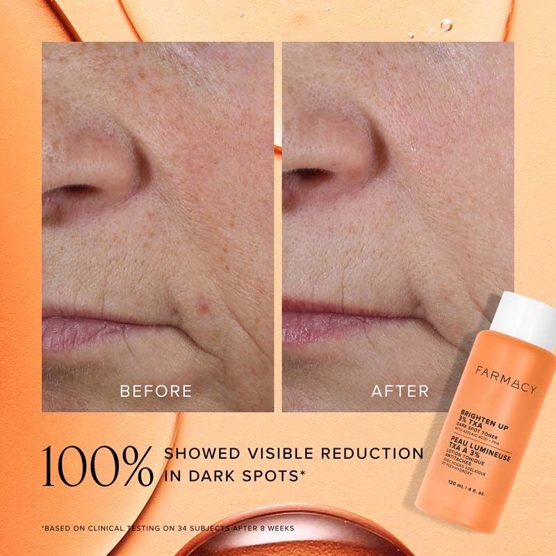 Farmacy Beauty Brighten Up 3% Txa Dark Spot Toner, 50ml