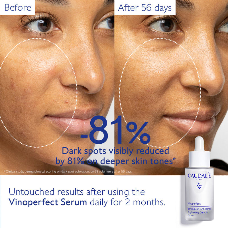 Caudalie Vinoperfect Brightening Dark Spot Serum, 30ml
