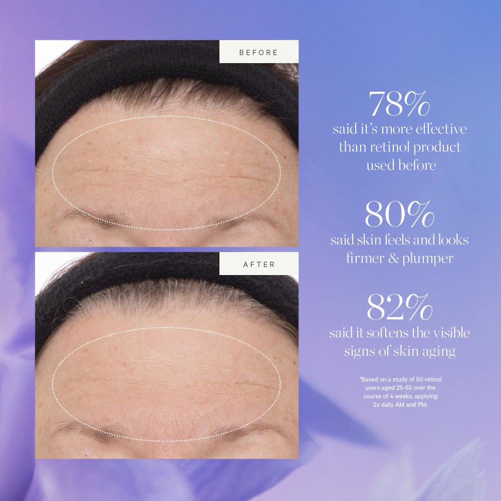 Kora Organics Plant Stem Cell Retinol Altertive Serum Firms Smooths Protect With Bakuchiol Rosehip, 30