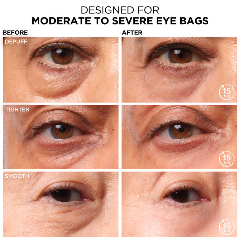 IT COSMETICS Bye Bye Under Eye Bags Daytime Treatment, 15ml