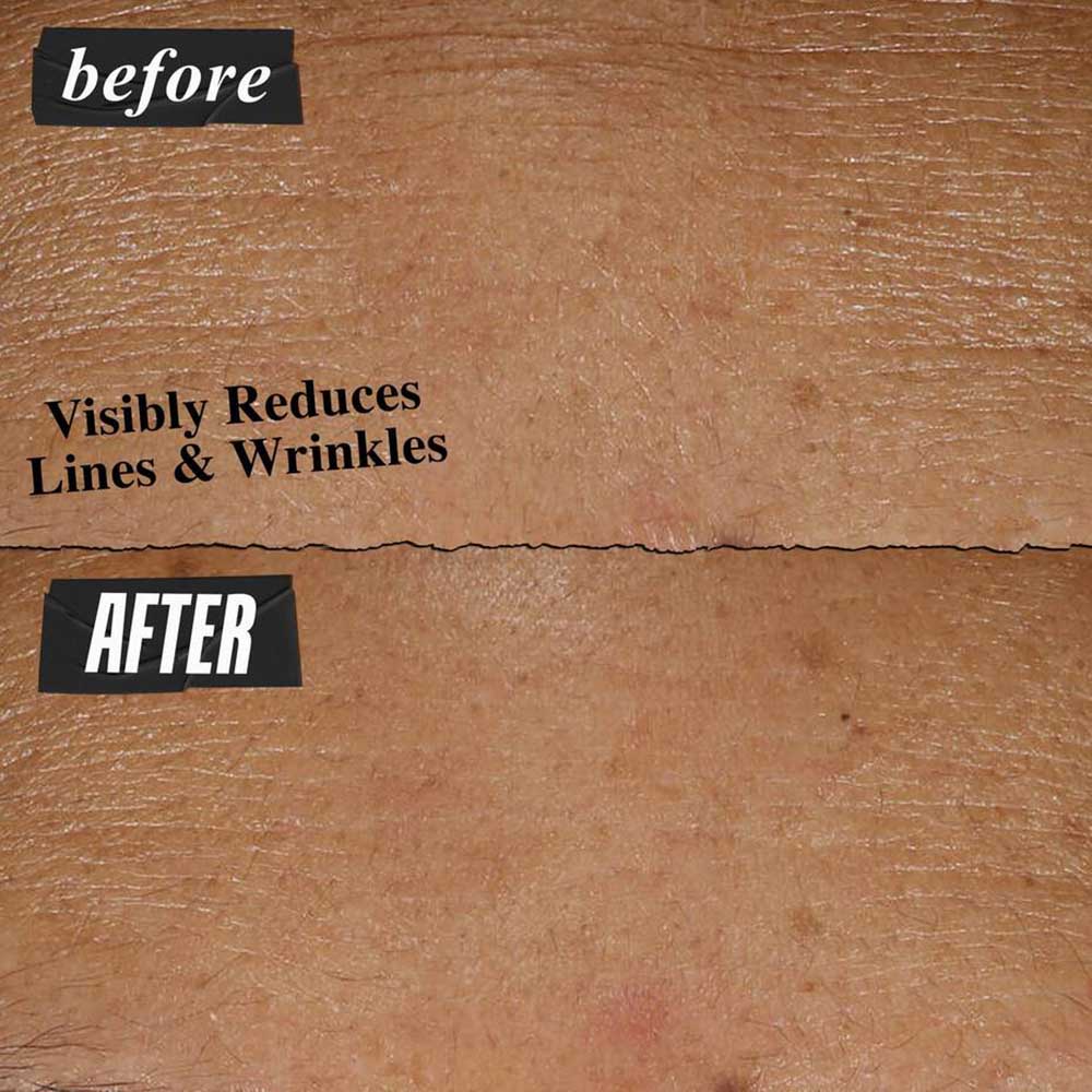 Kiehl's Micro-Dose Anti-Aging Retinol Serum - With Ceramides and Peptide, 30ml