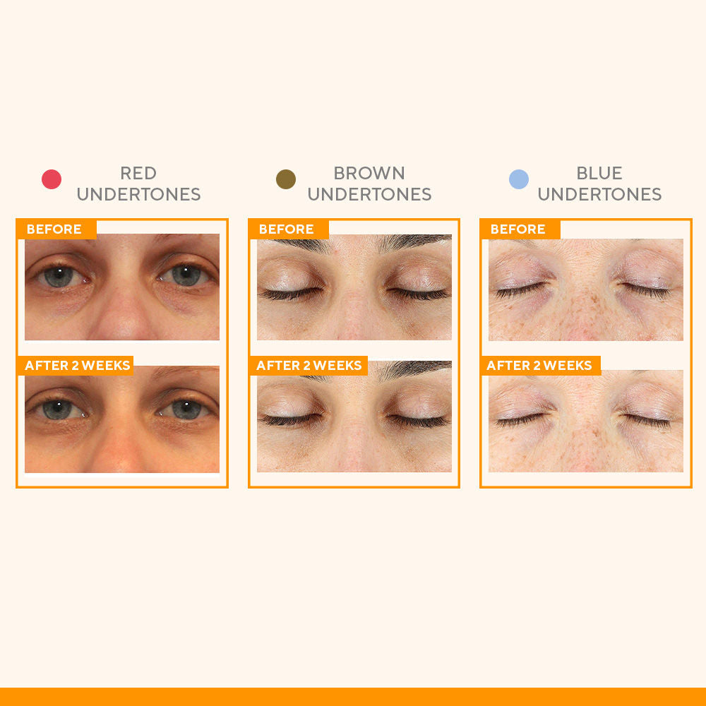 Murad Vitamin C Eyes Dark Circle Corrector, 15ml