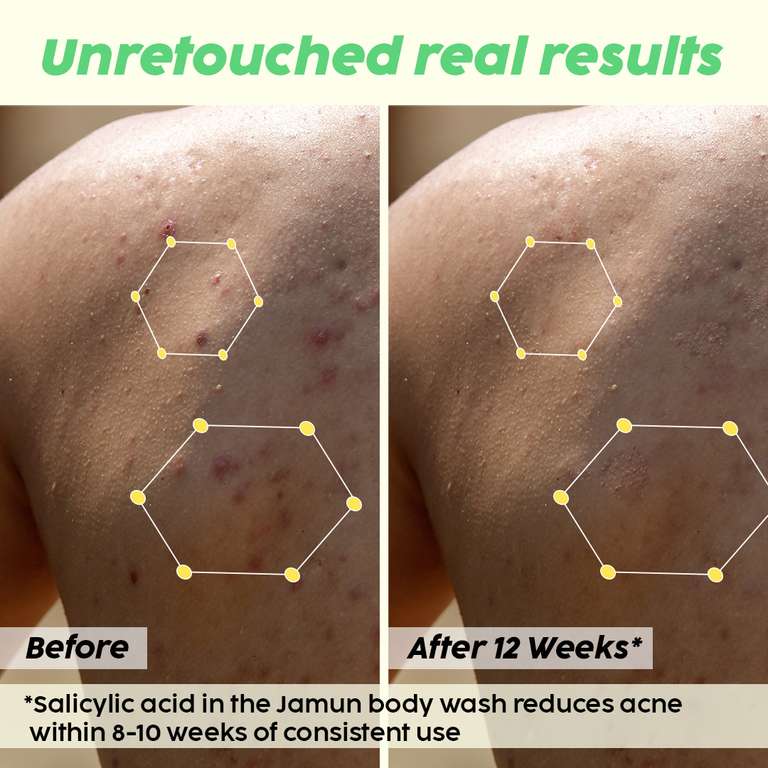 Plix Jamun 2% Salicylic Acid Body Wash For Body Acne, Bumpy Skin, 236ml | For All Skin Types Buy at Indicrest Image 3