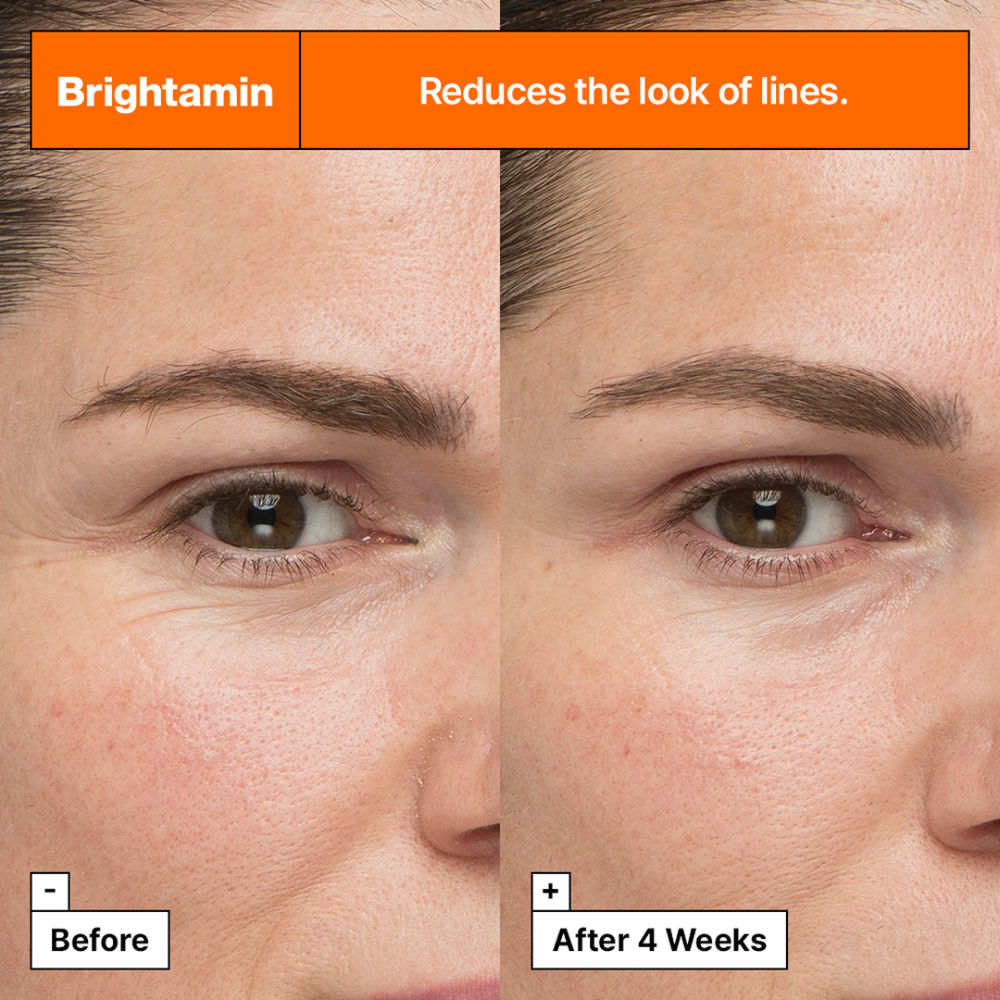 Dr.Jart+ Brightamin Brightening Serum Ampoule With Vitamin C & Niacinamide, 8ml