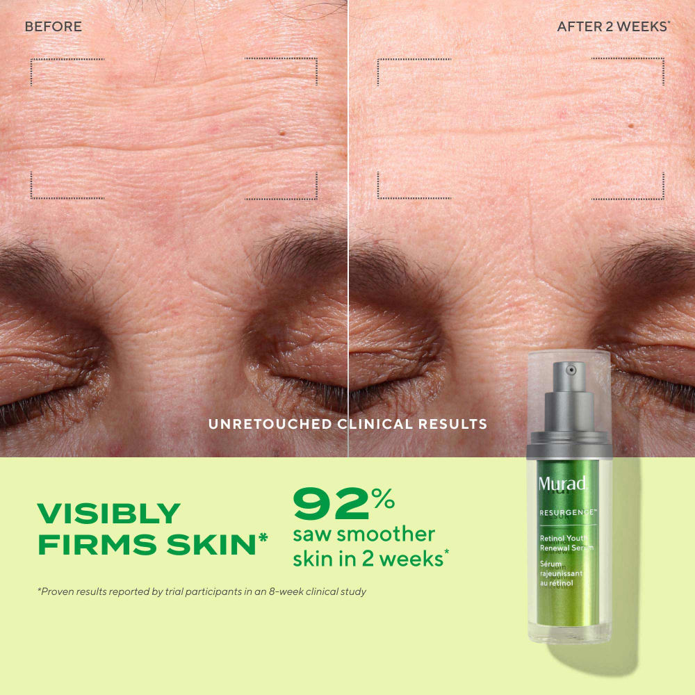 Murad Retinol Youth Renewal Serum, 10ml